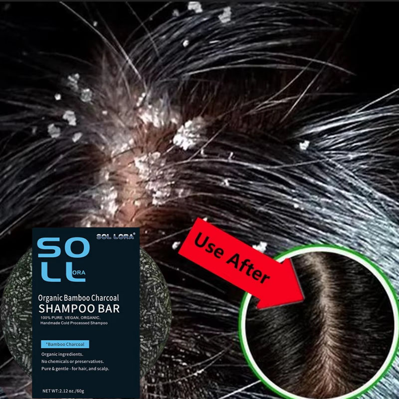 Быстрое средство против перхот – обзор и цена Hair Care Dandruff