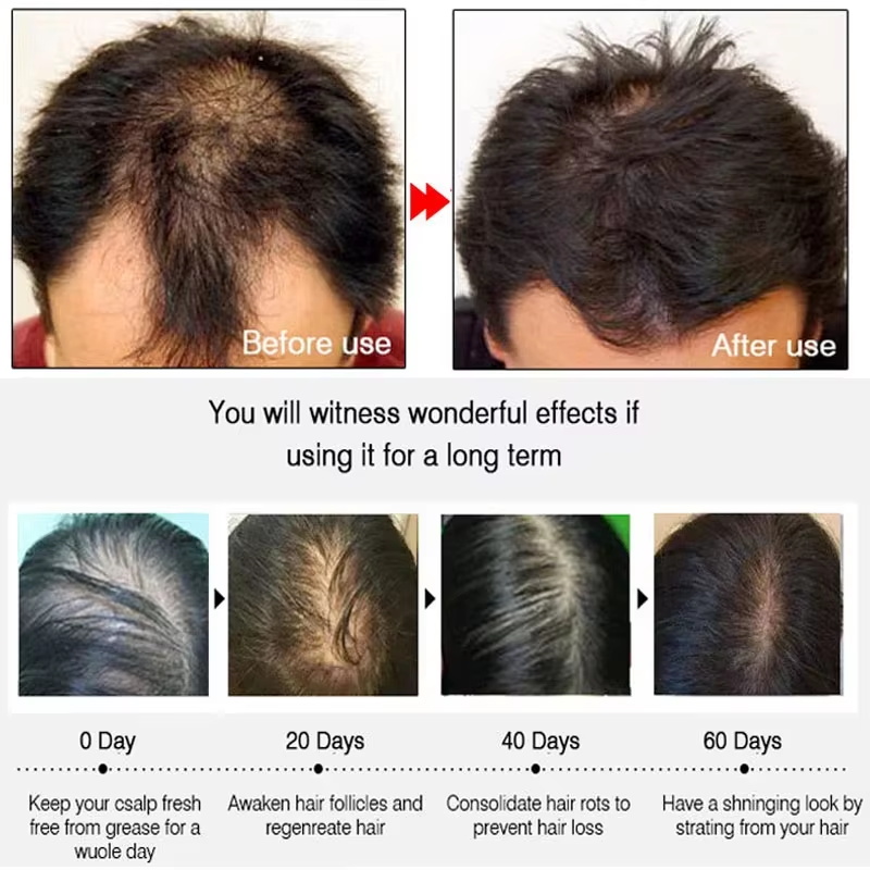 Спрей для быстрого роста волос – обзор и цена Hair Care Products